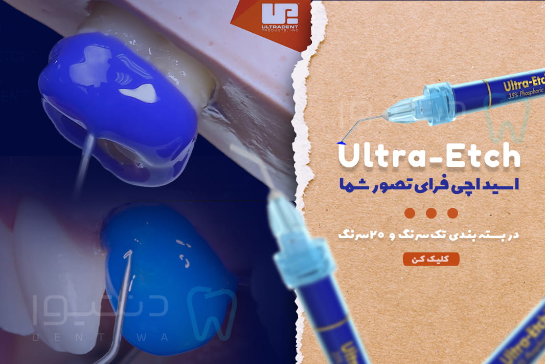 اسیداچ در فروشگاه دنتیوا