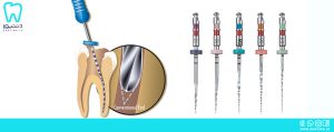 راه‌های خلاصی از شکستن فایل روتاری