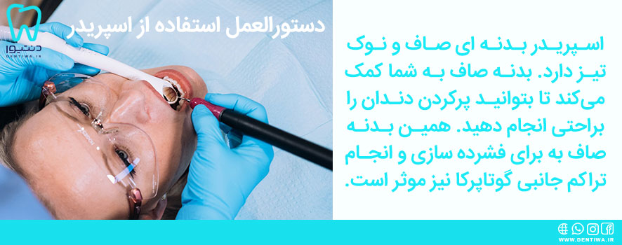 دستورالعمل استفاده از اسپریدر دندان‌پزشکی