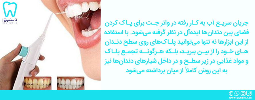 واترجت برای از بین بردن پلاک های دندان