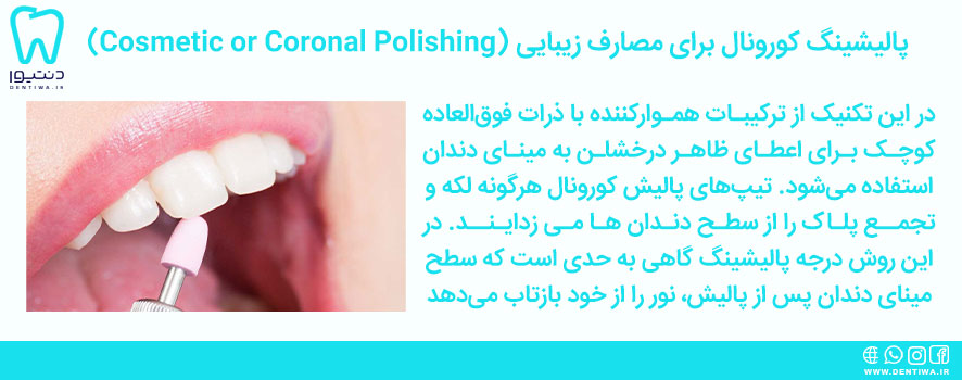 پالیشینگ کورونال برای مصارف زیبایی (Cosmetic or Coronal Polishing)