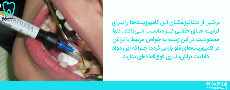 کامپوزیت های فلو برای دندانهای خلفی