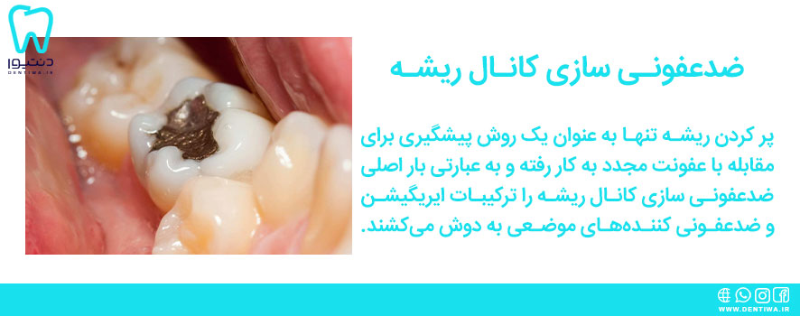 ضدعفونی سازی ریشه دندان