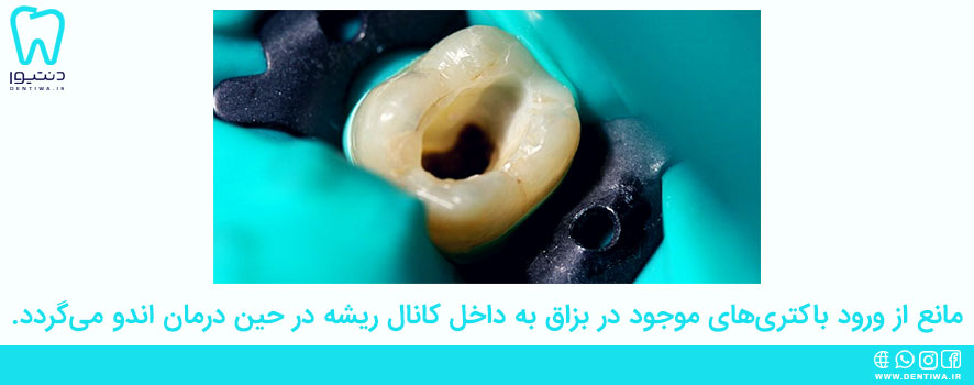 مزیت کاربرد رابردم دندانپزشکی