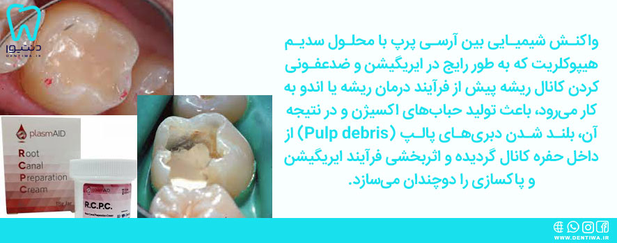 مشخصات آرسی پرپ دندانپزشکی