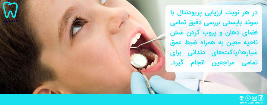 ارزیابی دندان ها با سوند دندانپزشکی