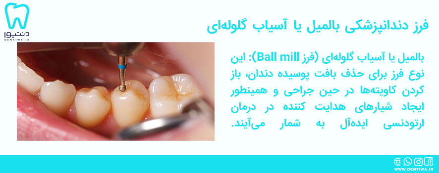 فرز دندانپزشکی بالمیل یا آسیاب گلوله‌ای