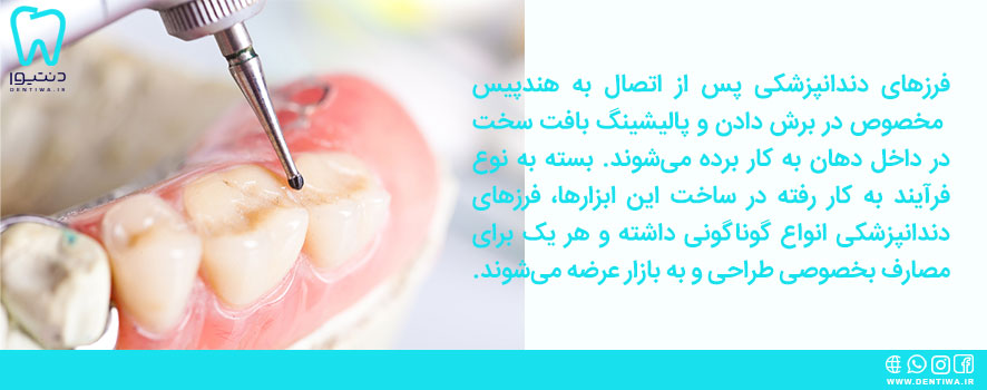 فرز دندانپزشکی چیست