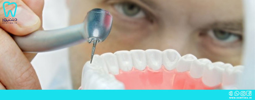 معرفی انواع فرز دندانپزشکی