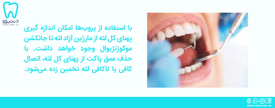 کاربرد سوند دندانپزشکی چیست