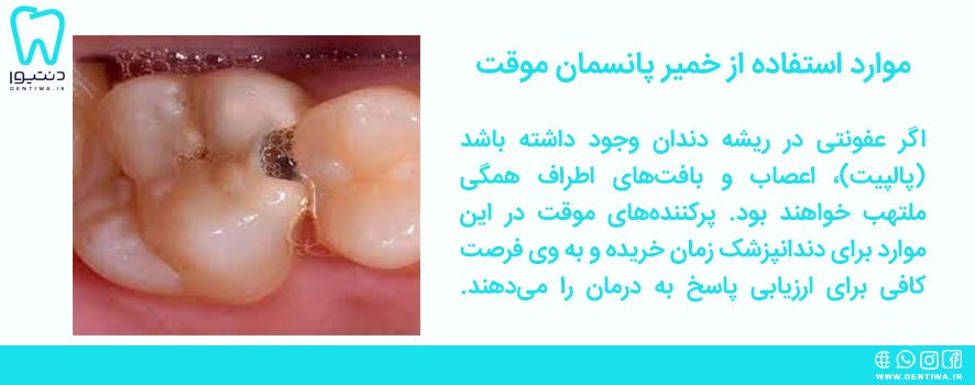 موارد استفاده از خمیر پانسمان موقت