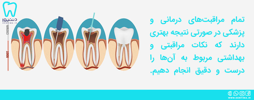 رعایت مراقبت های بعد از عصب کشی دندان