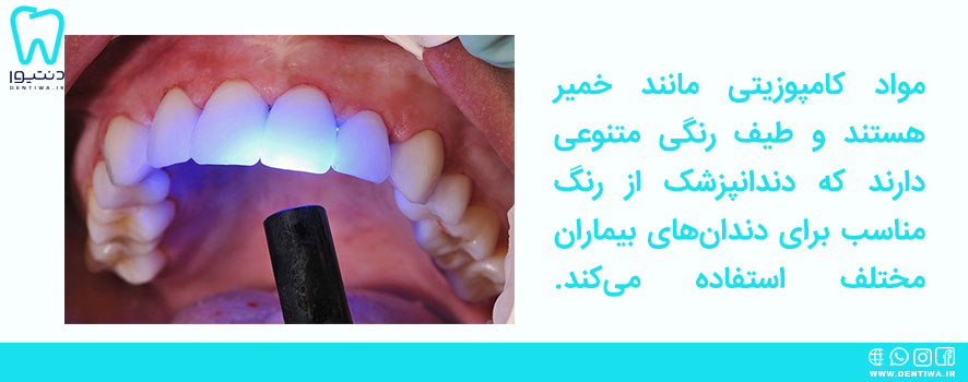 کامپوزیت دندان چیست و چگونه انجام می‌شود؟