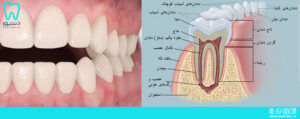 بررسی دندان های قدامی و خلفی