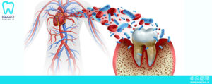 تأثیر بهداشت دهان و دندان بر سلامت قلب