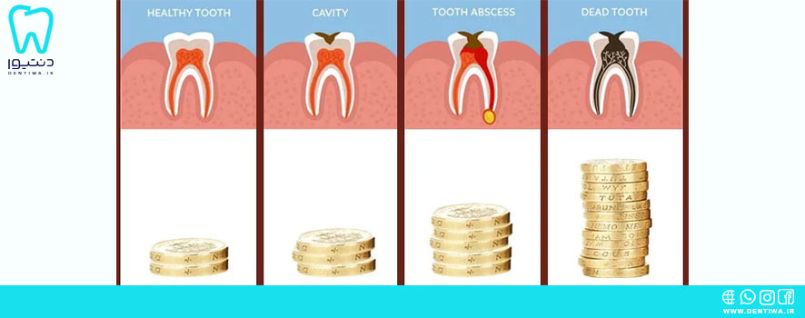 چرا تعرفه‌های دندانپزشکی گران هستند