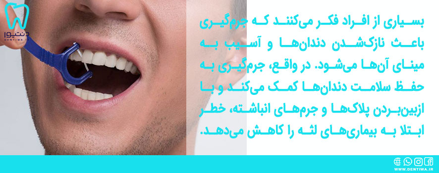 باورهای غلط درباره جرم گیری دندان