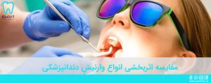 مقایسه اثربخشی انواع وارنیش دندانپزشکی